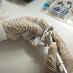 Prótesis total sobreimplantes (inferior)